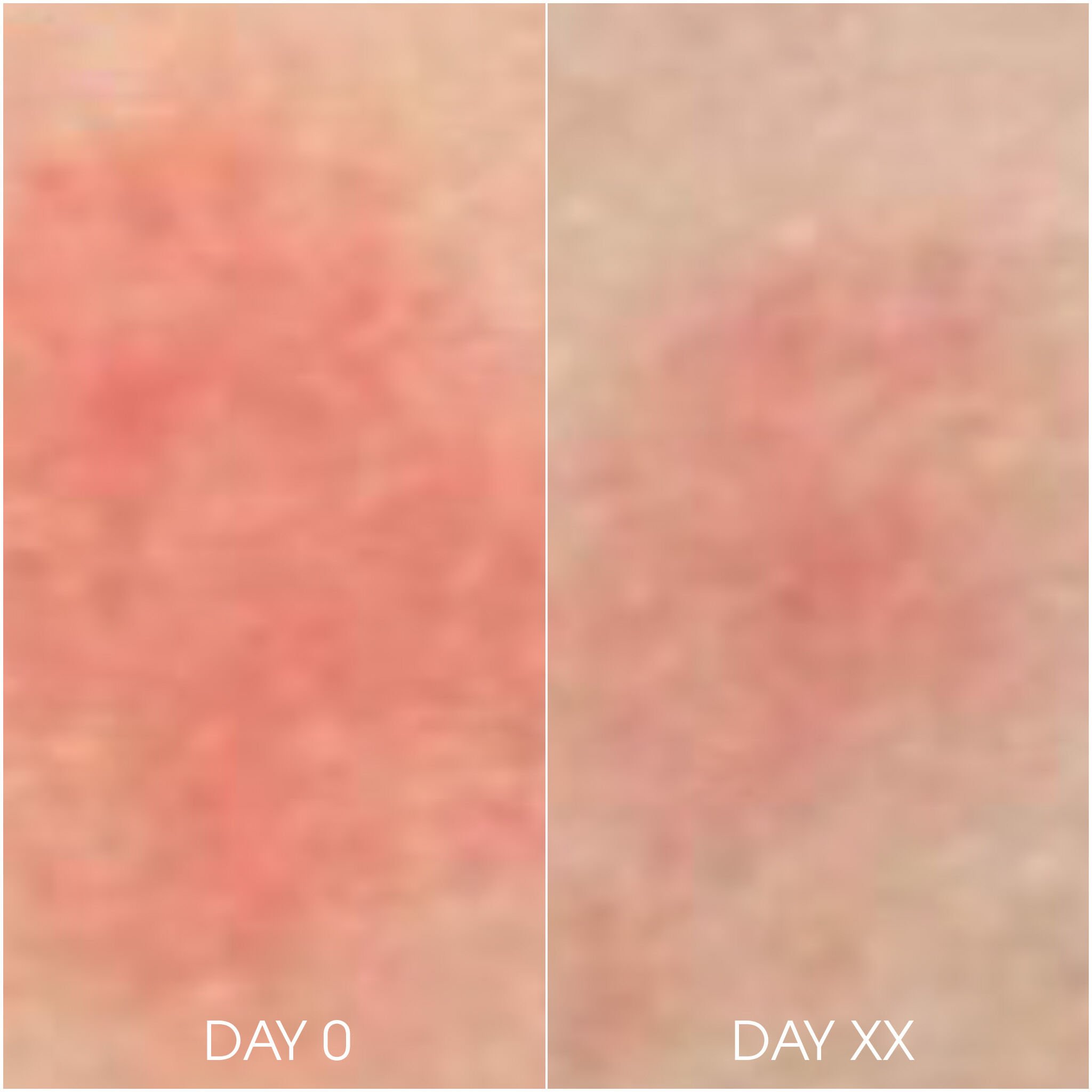 RHA® Deep Repair Balm